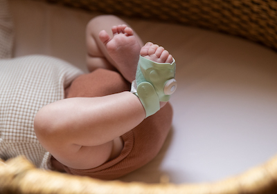 owlet sock leaving marks