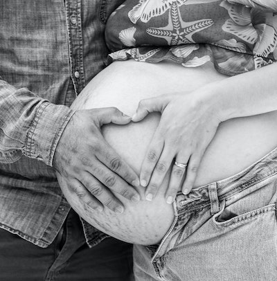 Do Stretch Marks From Pregnancy Go Away?