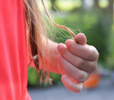 How much postpartum shedding is normal How much postpartum shedding is normal