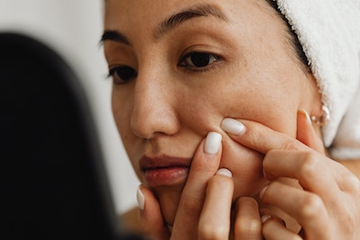 can i use retinol for acne while breastfeeding